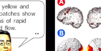 Brainage